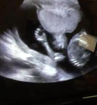 38645815_10216464118932488_3676325197436157952_n (kopia 3)